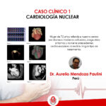 caso clínico, cardiología nuclear