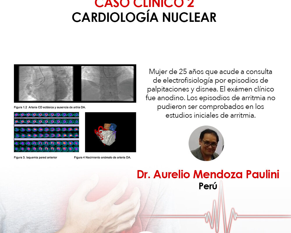 caso clínico, cardiología nuclear